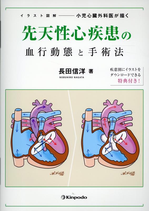 イラスト図解 小児心臓外科医が描く先天性心疾患の血