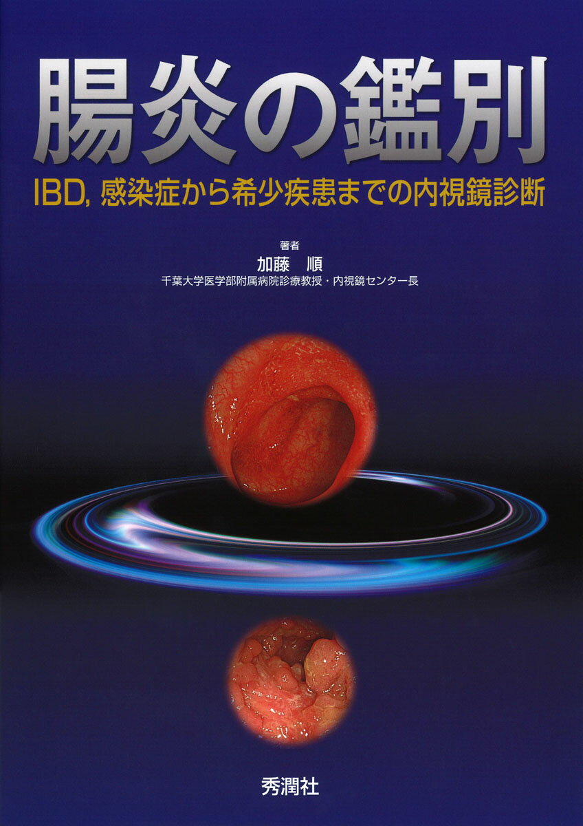 腸炎の鑑別 IBD 感染症から希少疾患までの内視鏡診断 [ 加藤 順 ]