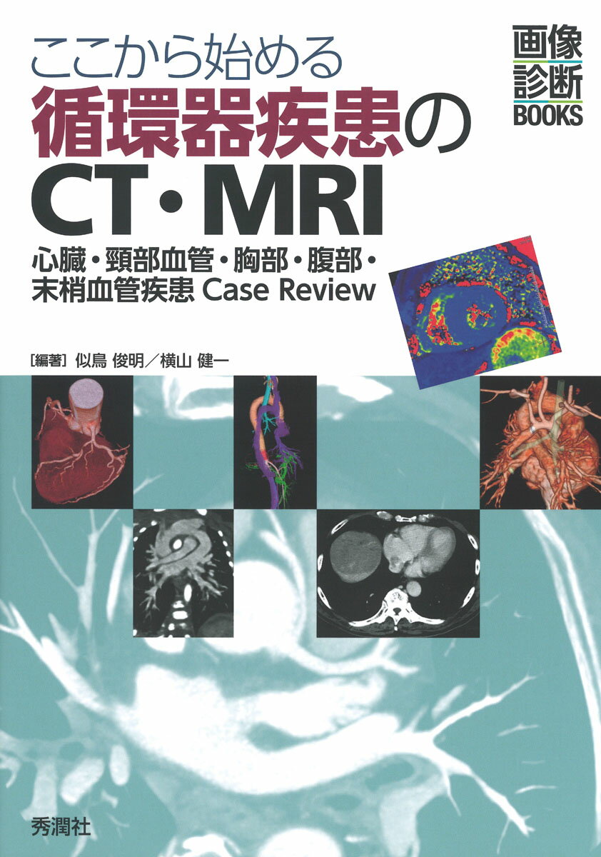 ここから始める循環器疾患のCT MRI ー心臓 頸部血管 胸部 腹部 末梢血管疾患Case Review- 似鳥俊明