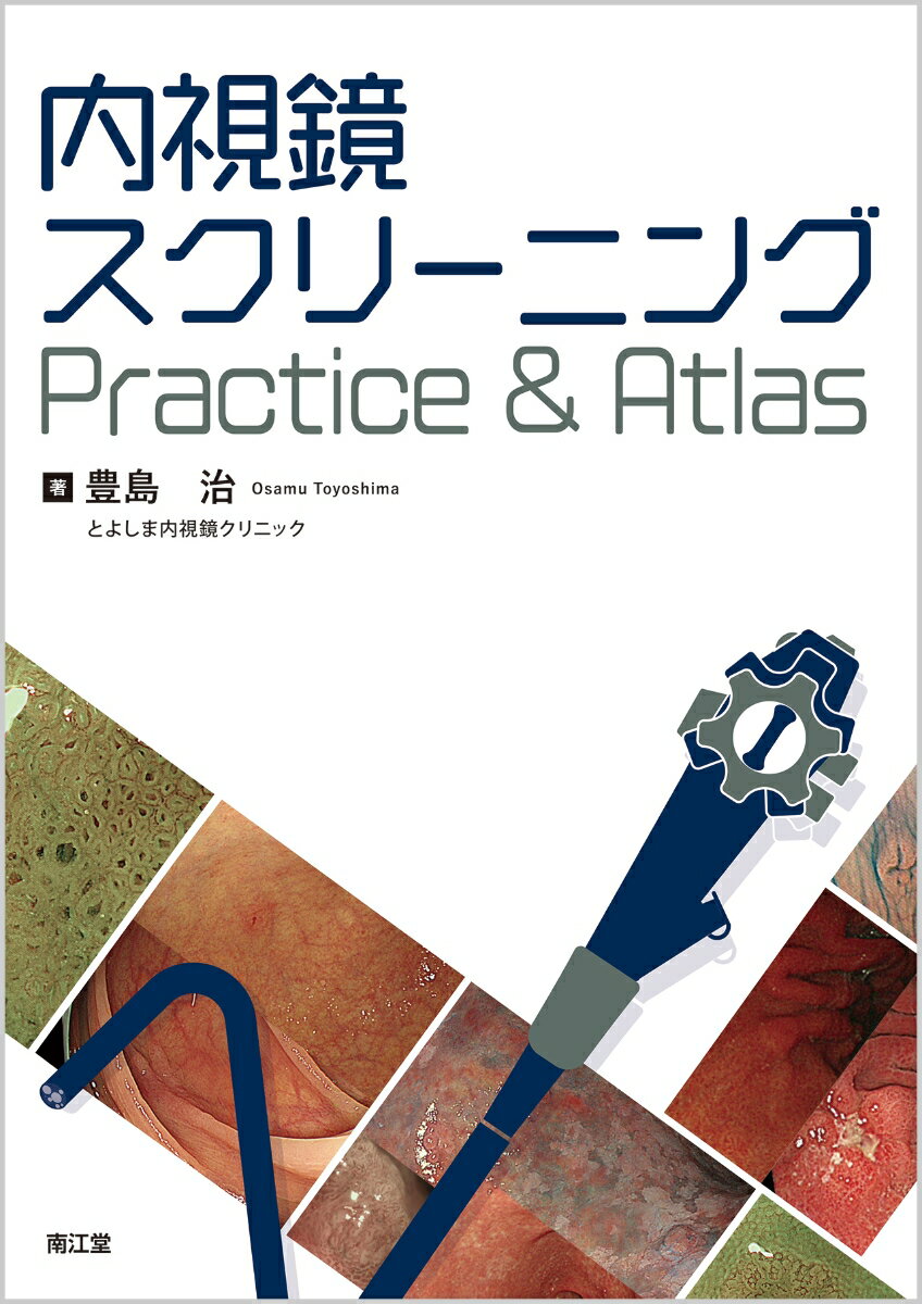 内視鏡スクリーニングPractice & Atlas [ 豊島 治 ]