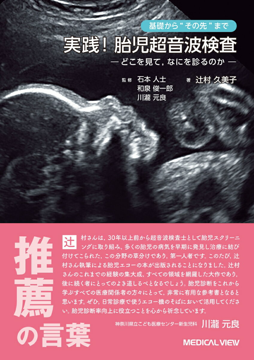 基礎から”その先”まで　実践！ 胎児超音波検査