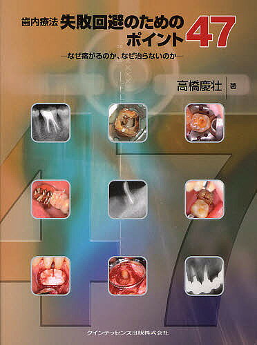 【送料無料】歯内療法失敗回避のためのポイント47 なぜ痛がるのか、なぜ治らないのか