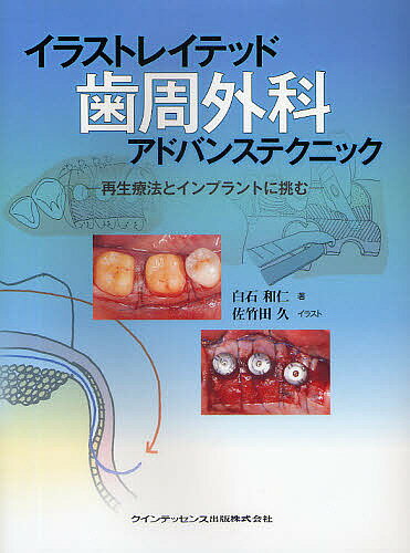 著者白石和仁(著) 佐竹田久(イラスト)出版社クインテッセンス出版発売日2009年02月ISBN9784781200613ページ数173Pキーワードいらすとれいてつどししゆうげかあどばんすてくにつく イラストレイテツドシシユウゲカアドバンステクニツク しらいし かずひと さたけだ シライシ カズヒト サタケダ9784781200613