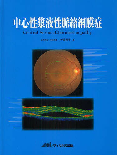 中心性漿液性脈絡網膜症／戸張幾生【1000円以上送料無料】