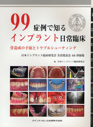 99症例で知るインプラント日常臨床 骨造成の予後とトラブルシューティング 日本インプラント臨床研究会全員発表会4th抄録集／日本インプラント臨床研究会【1000円以上送料無料】