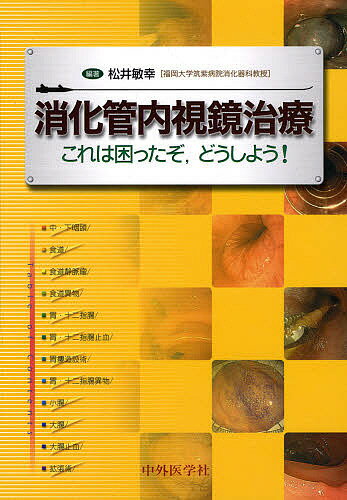 出版社中外医学社発売日2007年10月ISBN9784498041660ページ数250Pキーワードしようかかんないしきようちりようこれわこまつたぞど シヨウカカンナイシキヨウチリヨウコレワコマツタゾド まつい としゆき マツイ トシユキ9784498041660目次1 総論（内視鏡治療を行う際にそろえるべき器具・薬剤などを知りたい/止血をしようと思ったがエタノールしかない。慣れていない。どうしよう？/止血に最も適した器具（手技）を知りたい/内視鏡治療のインフォームド・コンセント（IC）どうしよう？/インフォームド・コンセント（IC）に最低限盛り込むべき項目を知りたい ほか）/2 各論（中・下咽頭/食道/食道静脈瘤/食道異物/胃・十二指腸 ほか）