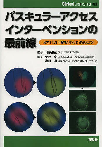 バスキュラーアクセスインターベンションの最前線 3カ月以上維持するためのコツ／阿岸鉄三／天野泉／池田潔【1000円以上送料無料】