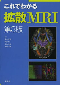 これでわかる拡散MRI/青木茂樹/阿部修/増谷佳孝【1000円以上送料無料】