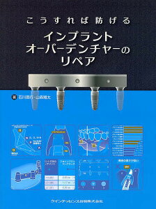 【送料無料】こうすれば防げるインプラントオーバーデンチャーのリペア/石川高行/山森翔太