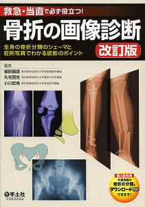骨折の画像診断 救急・当直で必ず役立つ! 全身の骨折分類のシェーマと症例写真でわかる読影のポイント/福田国彦/丸毛啓史/小川武希【1000円以上送料無料】