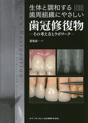 生体と調和する歯周組織にやさしい歯冠修復物 その考え方とラボワーク／遊亀裕一【1000円以上送料無料】