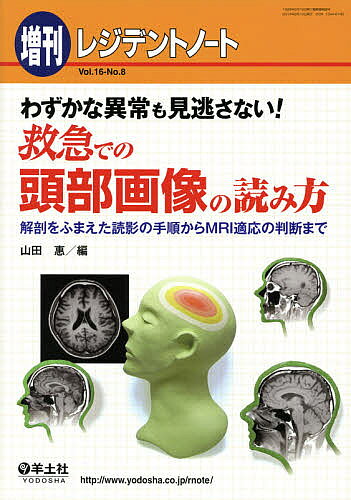 【送料無料】わずかな異常も見逃さない!救急での頭部画像の読み方 解剖をふまえた読影の手順からMRI適応の判断まで／山田惠
