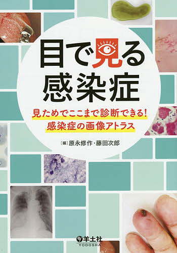 ※商品画像はイメージや仮デザインが含まれている場合があります。帯の有無など実際と異なる場合があります。著者原永修作(編) 藤田次郎(編)出版社羊土社発売日2015年07月ISBN9784758117746ページ数166Pキーワードめでみるかんせんしようみためでここまで メデミルカンセンシヨウミタメデココマデ はらなが しゆうさく ふじた ハラナガ シユウサク フジタ9784758117746内容紹介『目で見た診断ポイント』が凝縮！診断確定に必須の『病歴・身体所見・検査』も解説！感染症を“素早く確実に”診断できる力がつく！※本データはこの商品が発売された時点の情報です。目次総論 感染症を視覚的にとらえる/1章 口腔所見・喀痰所見からの感染症診断/2章 爪・皮膚所見からの感染症診断/3章 関節所見、およびリンパ節所見からの感染症診断/4章 呼吸器感染症の診断/5章 消化器感染症の診断/6章 HIV関連感染症の診断/7章 寄生虫疾患の診断
