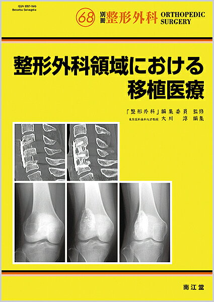 整形外科領域における移植医療／大川淳【1000円以上送料無料】