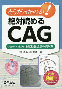 そうだったのか!絶対読めるCAG シェーマでわかる冠動脈造影の読み方/中川義久/林秀隆【1000円以上送料無料】