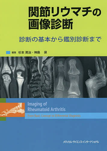 【送料無料】関節リウマチの画像診断 診断の基本から鑑別診断まで／杉本英治／神島保