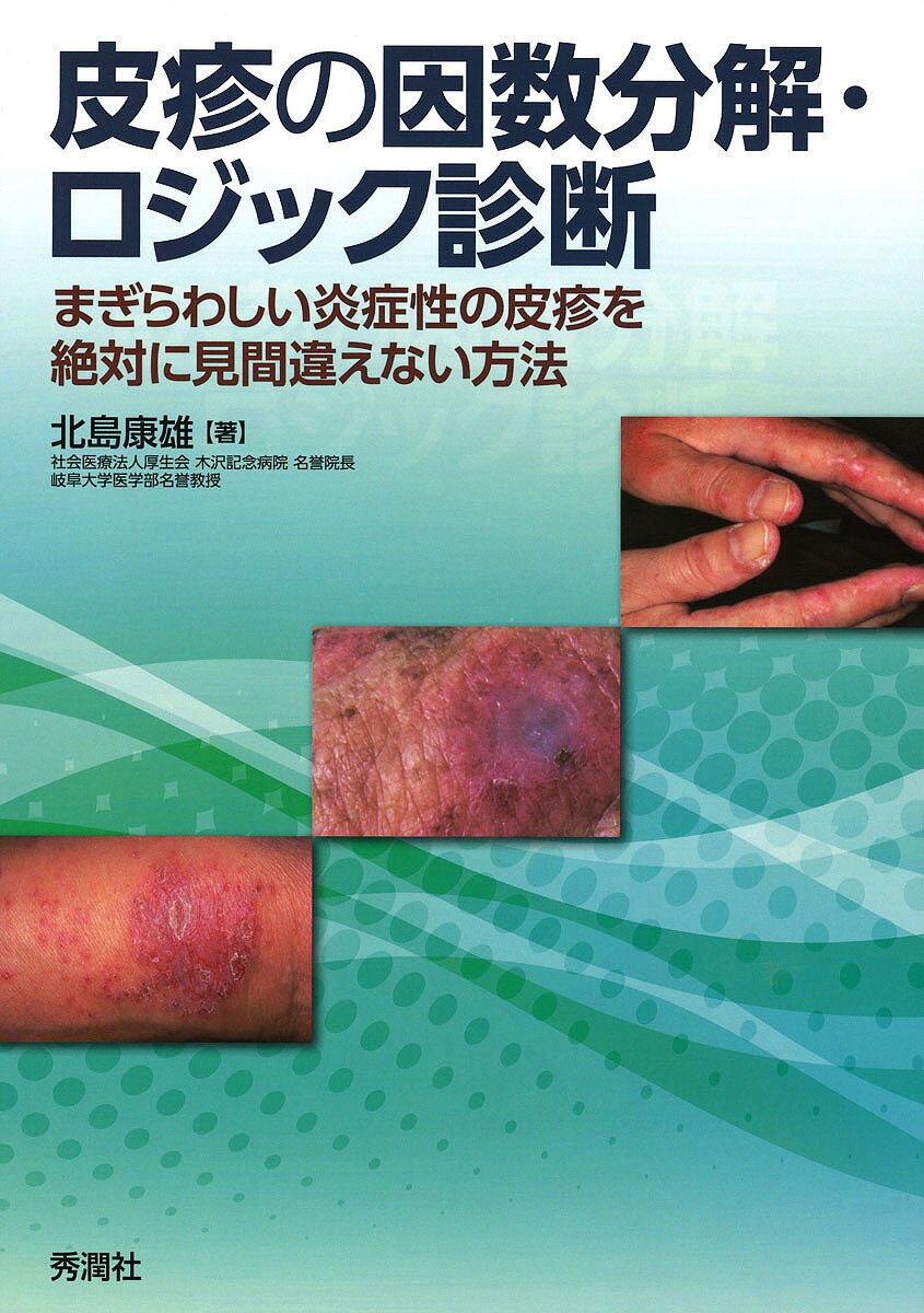 著者北島康雄(著)出版社学研メディカル秀潤社発売日2018年11月ISBN9784780909746ページ数190Pキーワードひしんのいんすうぶんかいろじつくしんだんまぎらわし ヒシンノインスウブンカイロジツクシンダンマギラワシ きたじま ...