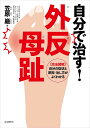 自分で治す 外反母趾 〈完全図解〉自分の症状と原因 治し方がよくわかる／笠原巖【1000円以上送料無料】