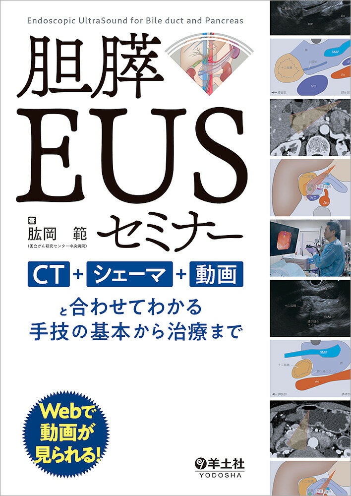 胆膵EUSセミナー CT シェーマ 動画と合わせてわかる手技の基本から治療まで／肱岡範【1000円以上送料無料】