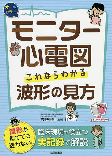 【送料無料】モニター心電図これならわかる波形の見方 オールカラー／吉野秀朗