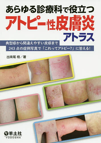 あらゆる診療科で役立つアトピー性皮膚炎アトラス 典型疹から間違えやすい皮疹まで243点の症例写真で「これってアトピー?」に答える!／出来尾格【1000円以上送料無料】