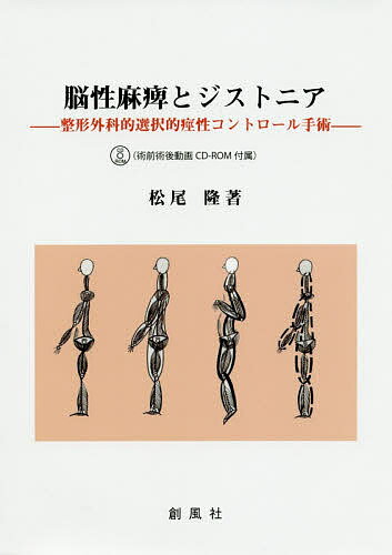 脳性麻痺の整形外科的治療 楽天市場】脳性麻痺の整形外科的治療の通販