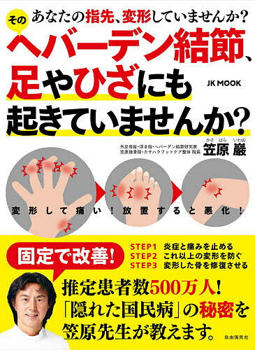 【送料無料】そのヘバーデン結節、足やひざにも起きていませんか? あなたの指先、変形していませんか?..