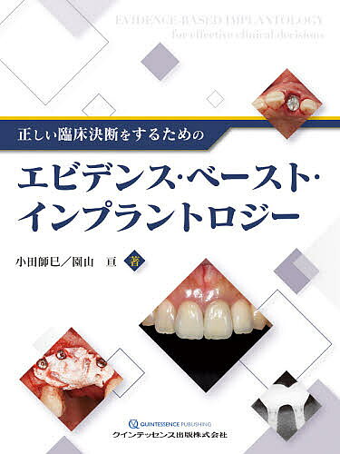 Odontology - 【送料無料】正しい臨床決断をするためのエビデンス・ベースト・インプラントロジー／小田師巳／園山亘