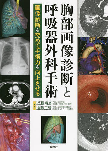 楽天市場】呼吸器外科手術 縦隔・胸膜・胸壁の通販