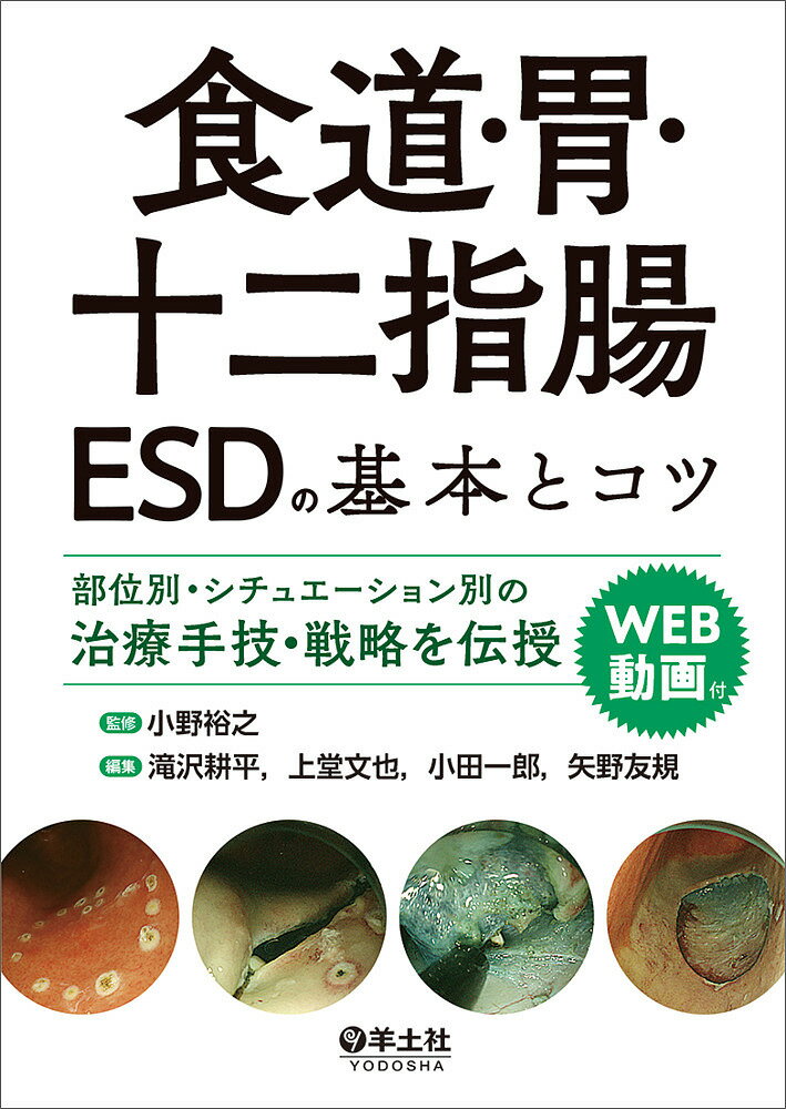 食道 胃 十二指腸ESDの基本とコツ 部位別 シチュエーション別の治療手技 戦略を伝授／小野裕之／滝沢耕平／上堂文也【1000円以上送料無料】