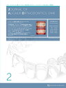 JOURNAL OF ALIGNER ORTHODONTICS{ vol.2issue2(2022)y1000~ȏ㑗z