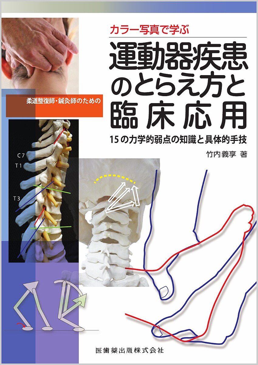 【送料無料】カラー写真で学ぶ柔道整復師・鍼灸師のための運動器疾患のとらえ方と臨床応用 15の力学的弱点の知識と具体的手技／竹内義享