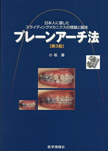 プレーンアーチ法 日本人に適したスライディングメカニクスの理論と臨床／小坂肇【1000円以上送料無料】