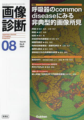 出版社Gakken発売日2024年07月ISBN9784055200691ページ数P860〜982キーワードがぞうしんだん44ー9（2024ー8） ガゾウシンダン44ー9（2024ー8）9784055200691内容紹介よく目にする呼吸器疾患の中で，非典型的な少し変わった画像所見や他の疾患を考えてしまう画像所見を提示。呼吸器疾患を専門としない放射線科医の読影力向上や日常診療においてより精度の高い読影をするために必読の特集！序説 ● 楠本 昌彦，江頭 玲子肺癌 ● 負門 克典，佐藤 嘉尚 ほか結核 ● 轟木 陽，青木 隆敏非結核性抗酸菌症 ● 宝関 明子，森本 耕三 ほか細菌性肺炎 ● 國弘 佳枝，小林 大河 ほか特発性肺線維症・過敏性肺炎 ● 江頭 玲子，武井 玲生仁器質化肺炎 ● 澄川 裕充感染症以外の肉芽腫性疾患 ● 冨永 循哉【連載】すとらびすむす教育はおもしろい！ ● 山本 憲画像診断と病理子宮体部原発神経内分泌癌 ● 八木 文子，秋田 大宇 ほかここが知りたい！画像診断2024年3月号特集「押さえておきたい呼吸器疾患の画像診断 Case-based review」● 中野 祥子，杉浦 弘明 ほかPicked-up Knowledge from Foreign Journals 神経放射線 ─血液眼関門 ● 森 墾Case of the MonthCase of August ● 吉田 耕太郎，山口 航ほか THE KEY TO Case of June ● 池之内 穣，佐藤 典子続General Radiology 診断演習 死せざるもの ● 服部 真也，久保田 姫子 ほか読影レポートLesson婦人科編「出血を伴う子宮筋層腫瘤」 ● 坪山 尚寛，村上 卓道 Refresher Course胎児MRI ─苦手意識を克服しよう！（前編） ● 中俣 彰裕 ，松木 充 ほか※本データはこの商品が発売された時点の情報です。