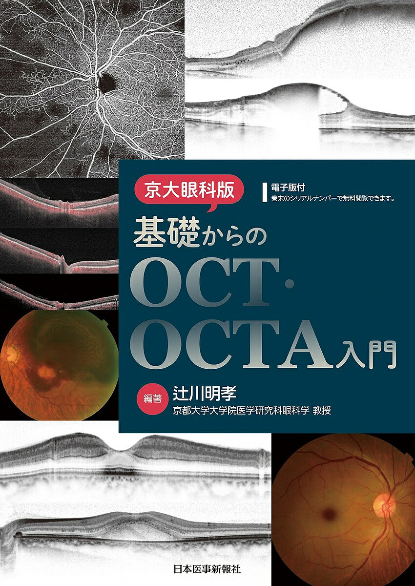 【送料無料】京大眼科版基礎からのOCT・OCTA入門／辻川明孝