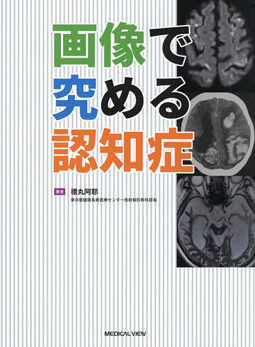 画像で究める認知症／徳丸阿耶【1000円以上送料無料】