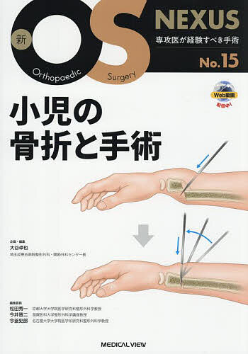 ※商品画像はイメージや仮デザインが含まれている場合があります。帯の有無など実際と異なる場合があります。著者大谷卓也(企画・編集)出版社メジカルビュー社発売日2025年08月ISBN9784758321655ページ数154Pキーワードしようにのこつせつとしゆじゆつしんおーえす シヨウニノコツセツトシユジユツシンオーエス おおたに たくや オオタニ タクヤ9784758321655内容紹介No.15では，小児の四肢の各部位における外傷の全体像と特殊性，注意すべきポイントを解説したうえで，頻度，要度の高い，あるいは筆者が得意とする術式について写真やイラストを多用してわかりやすく解説※本データはこの商品が発売された時点の情報です。目次1 基本的事項：骨折の診断、治療に入る前に（小児の骨折総論：診断と治療を始める前に知っておくべき基本事項/被虐待児症候群/肘内障の診断と治療）/2 上肢の骨折（手、手指の骨折/橈骨遠位骨折・骨端線損傷/Monteggia骨折：新鮮例、尺骨plastic bowing例、陳旧例 ほか）/3 下肢の骨折（足部・足趾の骨折（中足骨骨折）/足関節周囲骨折/脛骨骨幹部骨折・近位骨端離開（裂離骨折を除く） ほか）