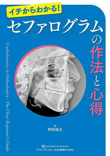 【送料無料】イチからわかる!セファログラムの作法と心得／村松裕之
