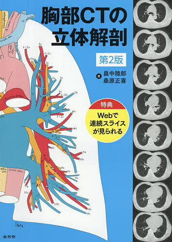 楽天市場】胸部ctの立体解剖の通販