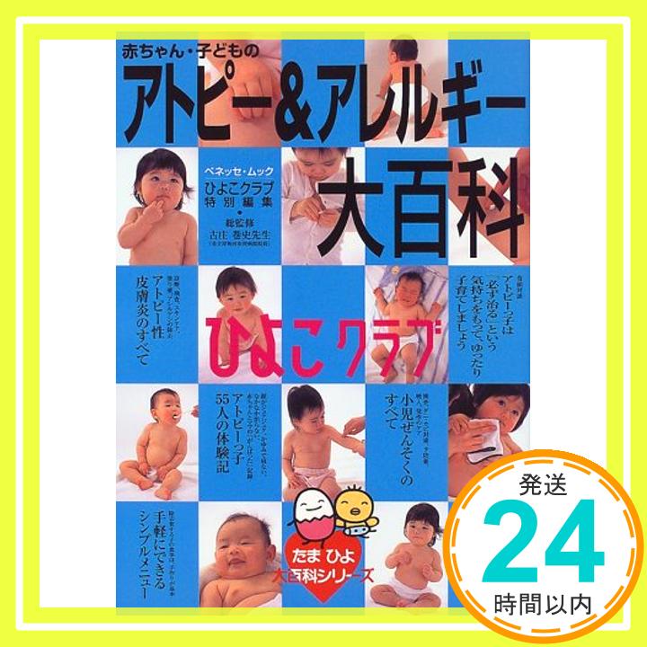 【中古】赤ちゃん 子どものアトピー アレルギー大百科 (ベネッセ ムック たまひよブックス たまひよ大百科シリーズ) 古庄巻史「1000円ポッキリ」「送料無料」「買い回り」