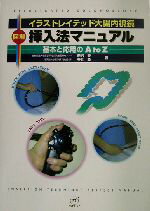 【中古】 図解　挿入法マニュアル 基本と応用のA　to　Z イラストレイテッド大腸内視鏡／岩男泰(著者),寺井毅(著者)