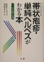 【中古】 帯状疱疹・単純ヘルペスがわかる本 正しい予防と治療/本田まりこ(著者)