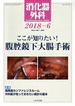 【中古】 消化器外科(2018−6) 月刊誌／へるす出版