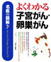 【中古】 名医の図解 よくわかる子宮がん・卵巣がん/清水敬生【著】