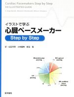 【中古】 イラストで学ぶ 心臓ペースメーカー/庄田守男(著者),小林義典(著者)