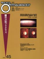 【中古】 開放隅角緑内障手術への決断／丸尾敏夫(著者)