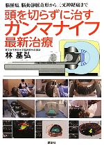 【中古】 頭を切らずに治すガンマナイフ最新治療 脳腫瘍、脳動静脈奇形から三叉神経痛まで 健康ライブラリースペシャル/林基弘【著】