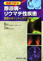 【中古】 画像で診る膠原病・リウマチ性疾患 読影のポイントとコツ/鎌谷直之【監修】,山田隆之【編】