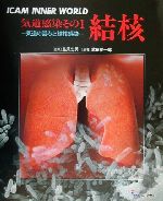 【中古】 気道感染(その1) 気道の営みと結核感染-結核 ICAM　inner　world気道感染その1／武田純一郎(著者),島尾忠男