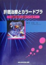  肝癌治療とカラードプラ 治療計画から造影ドプラまで／安原一彰(著者)